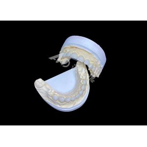 Customization Ultra Thin Glass Ceramic Veneers High Translucency for a Natural