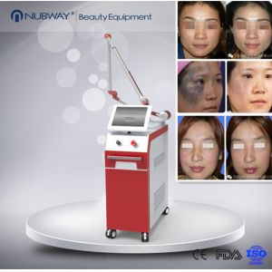 Most advanced multifunctional Q Switched Nd Yag Laser  Machine :Pigment removal,Tattoo removal,Skin rejuvenation.