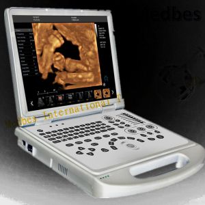 4D Baby Portable Medical Color Doppler Ultrasound Machine