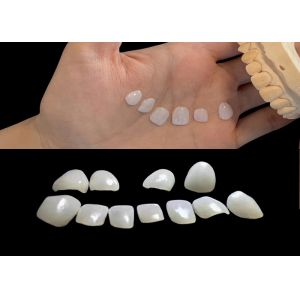 Ultra Thin Ceramic IPS EMAX Veneer Stain Resistance For Esthetic Restorations