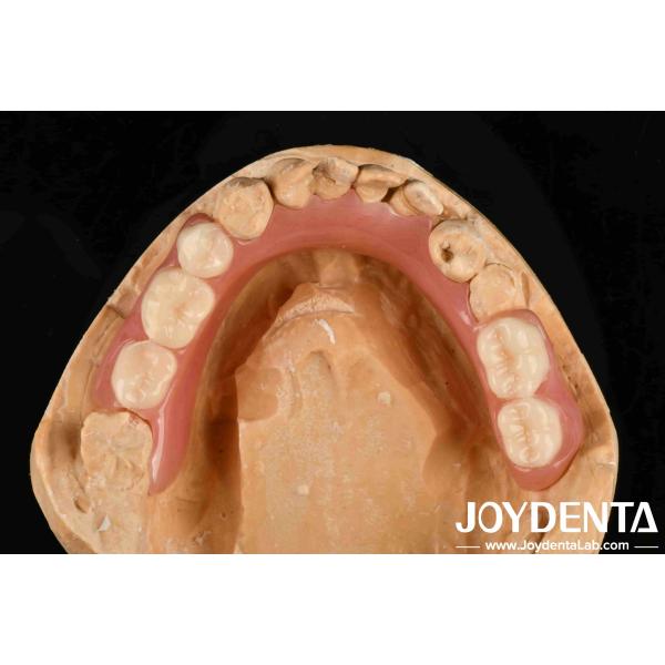 Quality Personalized Customization Acrylic Denture Finish Good Elasticity And Lightweight Property For Enhanced Prosthetic Performance wholesale