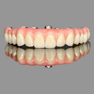 China Class I AOX Implants All On 4 Hybrid Titanium Screw Retained Full Zirconia on sale