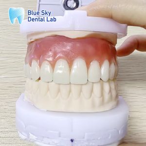 Custom Full Upper Acrylic Denture Natural Acrylic Removable Partial Denture