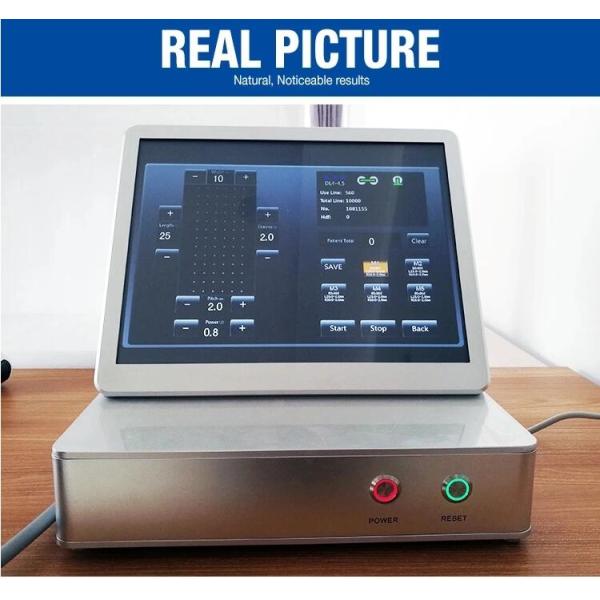 4MHz 11 Lines Portable Hifu Machine / 20000 Shots 2D Hifu Face lift Treatment