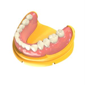 Foundation 3d Printer Dental Resin Customized Biocompatible Resin 3d Printing