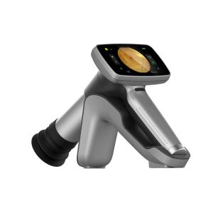 Video Ophthalmoscope 45° Handheld Fundus Camera