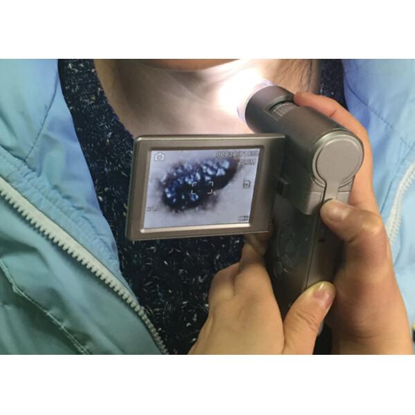 Quality Electronic Skin And Hair Inspection Device Video Dermatoscope Camera With 3 Inch TFT Color Display wholesale