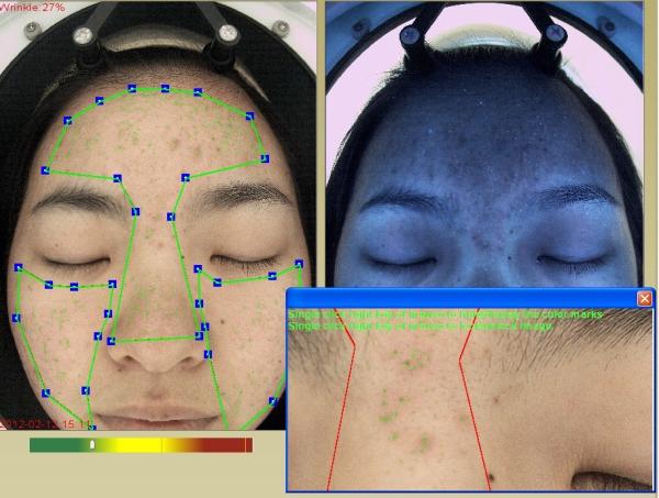 Quality Cosmetics Using 3D Wrinkle Analysis Machine RGB + UV + PL 3 Spectrums wholesale