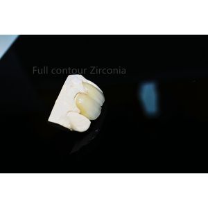 Durable Full Ceramic Zirconia Crown Thin Beautiful Custom Shape