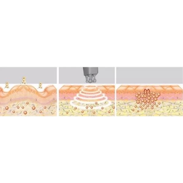 LED Vacuum RF Facial Lifting Cavitation Body Slimming Machine