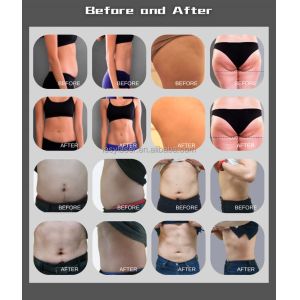 50-60hz Non Invasive Body Sculpting Machine , 800w Tesla Sculpt Machine