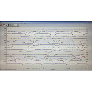 Portable Ultrasonic Flaw Detector Ultrasonic Testing Equipment For Aerial