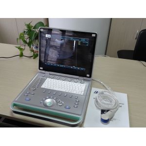 3D Digital Laptop Portable Ultrasound Scanner With All Kinds of Probe
