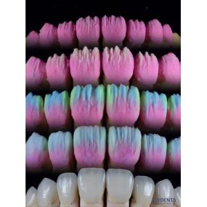 China The Joydenta Ceramic Veneer Process on sale
