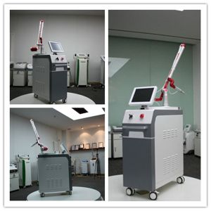 New advanced q switch nd yag laser sapphire ruby laser tattoo removal machine