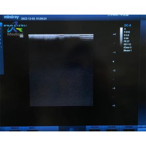 Mindray L14-6NE Ultrasound Transducer Probe Replace Crystal Array For Endocavity