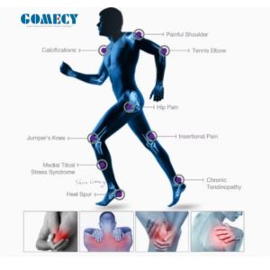 Vertical Piezoelectric FSWT Shock Wave Therapy Device for Pain Management