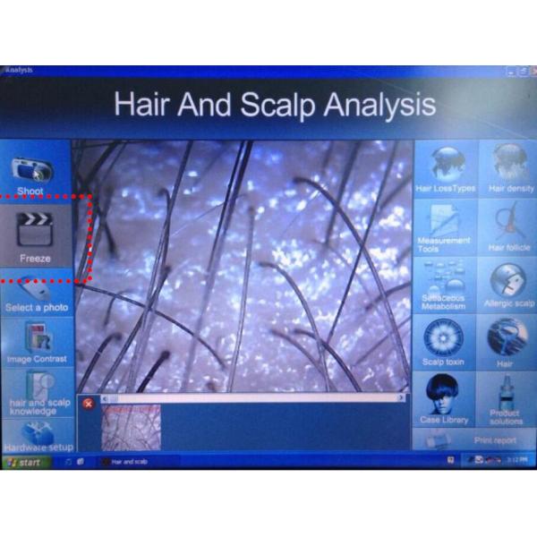 2016 NEW Sanhe SH650-1 808nm 650nm low level laser hair regrowth machine with CE