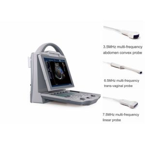 China Portable Pregnancy Ultrasound Scanner with Abdominal Convex Transvaginal Transducers on sale