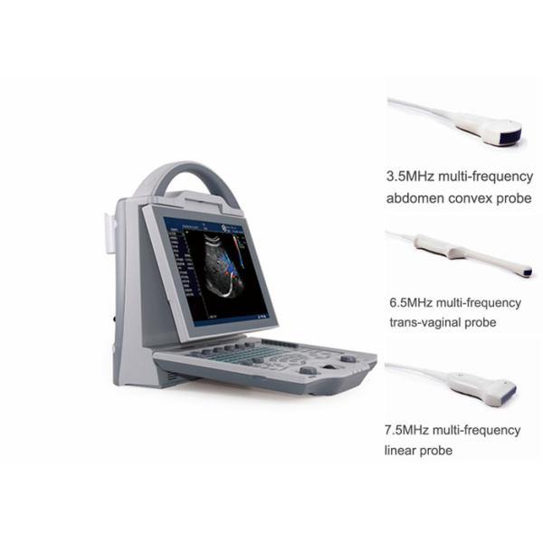 Quality Portable Pregnancy Ultrasound Scanner with Abdominal Convex Transvaginal Transducers wholesale