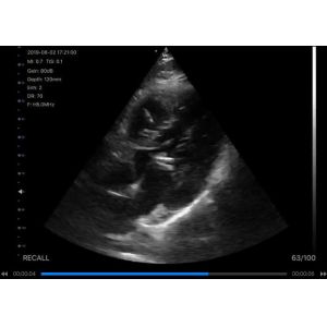 5G Handheld Ultrasound Scanner Convex: 3.5~5MHz, Linear: 7.5~10MHz, Cardiac: 2.5