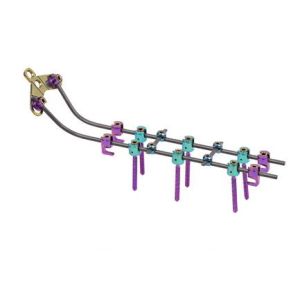 Posterior Cervical Internal Spine Fixation System , Pedicle Screw System