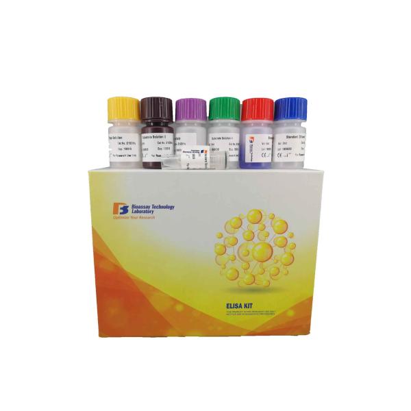 Customized Anti-nuclear Antibody Mouse ELISA kit Pre - Coated with Mouse ANA