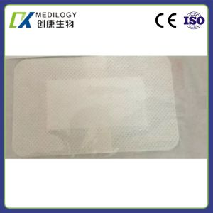 China Self Adhesive Plaster Non Woven Wound Dressing Hemostatic Surgicel Dressing Dental on sale
