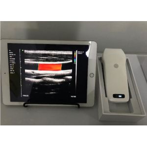 Pocket Wireless Ultrasound Probe Handheld Ultrasound Probe Mini Ultrasound Only