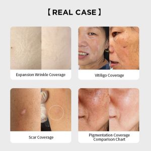 PMU Micro Skin Tone Ink Stretch Mark Camouflage Pigments