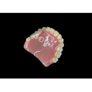 Full Arch Acrylic Denture An Affordable Solution for International Removable
