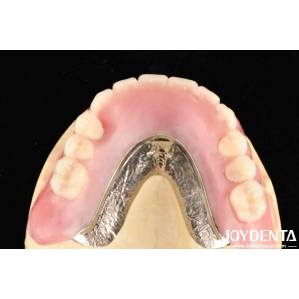 Firmly Connect Row Teeth Elaborate Technology Framework Set Up Teeth Finish For