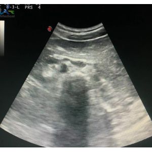 MyLab 50 Biosound CA541 Convex Array Ultrasound Probe For Diagnosis