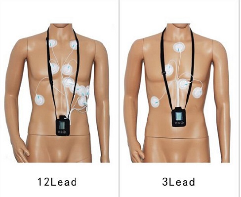 Quality China 12 Channels Holter EKG Monitor EKG Software 24 Hours 3-Channels iTengo CE Mark Pocket Size 60g wholesale