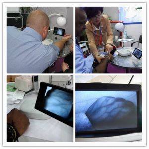 Safe Light Source No Laser Vein Locator Device With High Resolution