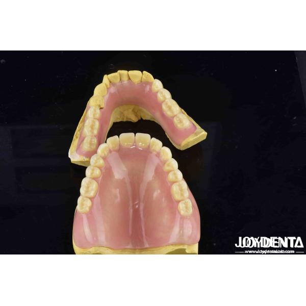 Unleash Potential Of Your Dental Practice Acrylic Denture Finish With Diverse