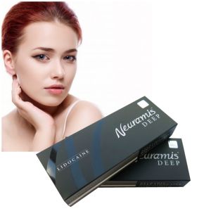 Superficial To Deep Face Treatment With Neuramis Dermal Filler Swelling Side