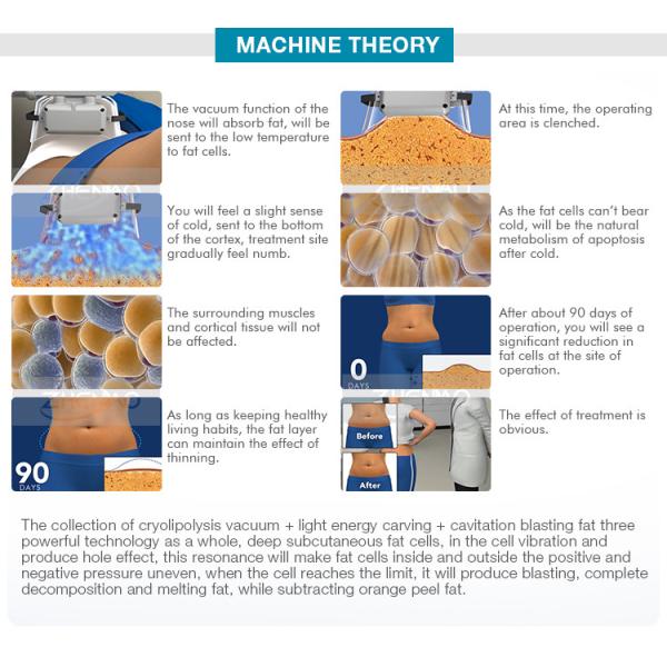 Cellulite Lipo Fat Freezing Cryolipolysis Machine RF 1000W For Salon