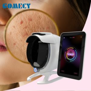 China Beauty Spa Skin Care CentersDigital Partner For Skin Analysis With Al Intelligent System Acne Pigment Pores Test and Analysis on sale