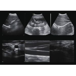 Doppler Ultrasound Equipment Hand held Doppler Machine 128 Elements 90~200mm