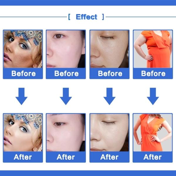 Portable 3 In 1 40K Rf Home Ultrasonic Cavitation Body Slimming Machine