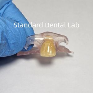 Dental TCS Valplast Flexible Partial Dentures Staining Fading Odors Resistant