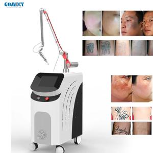 High Effective Q-Switched ND YAG Laser Eyeline Tattoo Removal Machine
