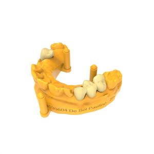 Low Temperature Expansion Coefficient Permanent Crown Resin Close to Natural