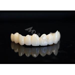 China Precision Made Solid Zirconia Crown For Perfect Dental Fit And Comfort on sale
