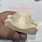 Removable Cast Clear Framework Partial Easy To Clean And Take Off