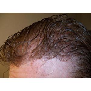 Adhesive Attachment Custom Hair System Lace or PU Base Material