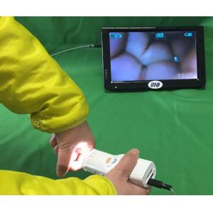 Portable Digital Electronic Colposcope