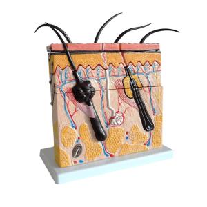 70 X Enlarged Medical Human 3D Skin Anatomy Model Training Skin Model