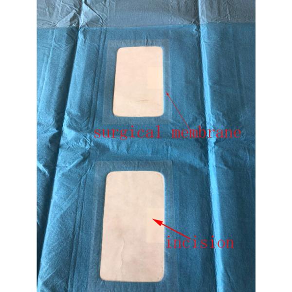 ANSI Standard Sterile Femoral Angiography Drape No Fluorescence